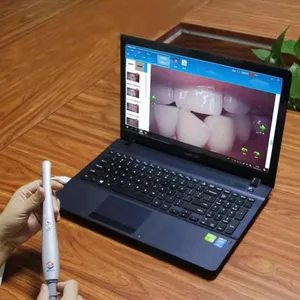 USB像素camara口腔内牙科支持视频记录