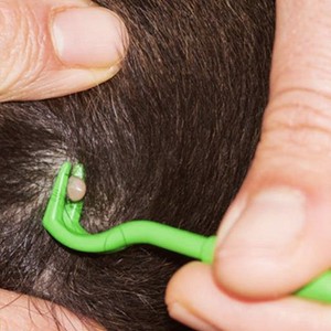 Haustier 3 Stück ABS Kunststoff Haustier Reinigungs mittel Haken Kratzen Zecken Werkzeug Floh Laus Entferner Schmerzfrei Schnelle Zecken entferner - Product Image 1