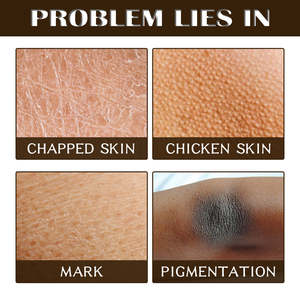 ACE & udy & amp; crub & amp; remachadora eratina & amp; rizing & oisturizing & amp; EA & Alt & amp; ore & amp; ribeteado & amp; Kin & amp; Muoth & amp; xfoliante - Product Image 4