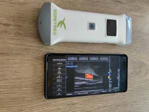 Sonde à ultrasons Doppler linéaire convexe 2 en 1 sans fil Wifi Machine à ultrasons sans fil couleur portable - Product Image 5