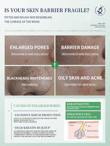 Suero Exfoliante Químico Facial con Ácido Glicólico, Láctico y <span class=keywords><strong>AHA</strong></span>/BHA, Solución Anti Poros, Aclarante Triple Ácido, Venta al Por Mayor OEM - Product Image 3