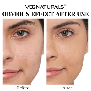Tonique facial au riz noir fermenté OEM, eau d'essence de riz hydratante et antioxydante, soin apaisant non irritant à absorption rapide - Product Image 4