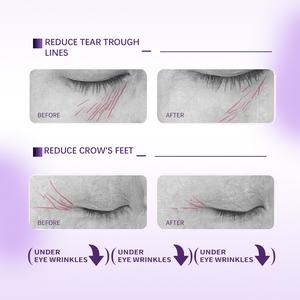 Crema Contorno Occhi Antirughe al Peptide di Ginseng - Estratto Vegetale per Linee Sottili e Occhiaie |   Fornitore all'Ingrosso - Product Image 5