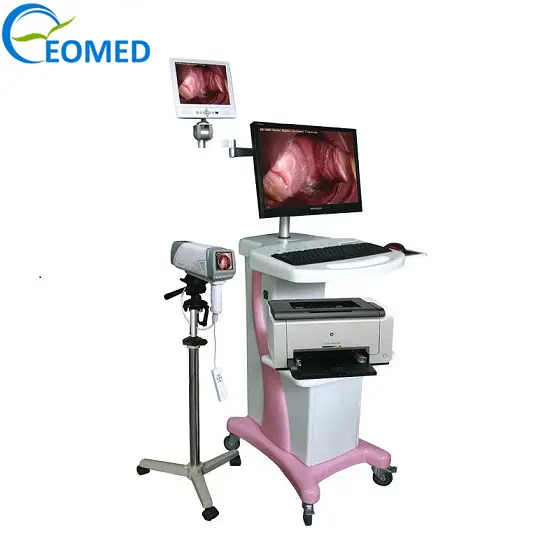 Digital HD Video Colposcope detect vulva, vagina, cervical disease diagnosis and inspection DVC5004