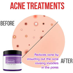 Niet-Antibiotische Probiotische Huidcrème-Allemaal Natuurlijke Actuele Probiotische Lotion Nieuwe Huidtherapiecrème Voor Een Droge Jeukende Huid - Product Image 3