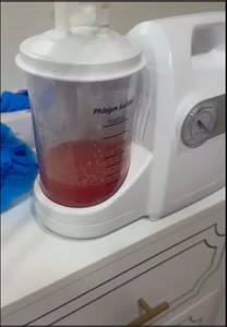 Aspirateur manuel à pédale pour aspiration de purulences, mucosités et sang lors d'opérations chirurgicales et d'avortements - Product Image 5