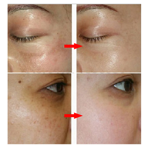 Crema Aclaradora de Pecas OEM de 7 Días, Elimina la Melanina, Pecas, Manchas Oscuras, Crema Blanqueadora Facial para Piel Negra - Product Image 5