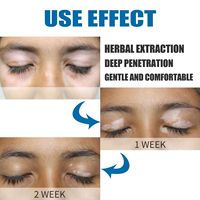 Crème corporelle OEM pour estomper les taches, éclaircir le teint et traiter le vitiligo, à base d'ingrédients chinois