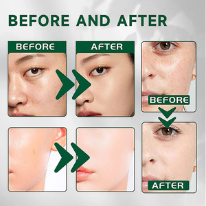 <span class=keywords><strong>Mascarilla</strong></span> Facial en Barra de <span class=keywords><strong>Arcilla</strong></span> Volcánica con Té <span class=keywords><strong>Verde</strong></span> y Rosa Orgánica de Marca Propia, Hidratante Natural, Tratamiento para el Acné, Limpiador <span class=keywords><strong>Purificante</strong></span> - Product Image 4