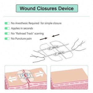 Best Price Xkmedica Medical Pe Waterproof <b>Tape</b> - Product Image 3