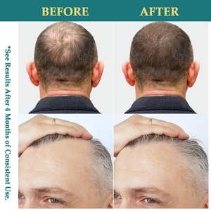 Spray para el Crecimiento del Cabello con Logotipo Personalizado OEM, Cuidado Capilar Orgánico, Aumenta el Grosor, Mejora la Salud del Cuero Cabelludo - Product Image 6