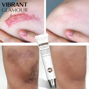 VIBRANT GLAMOURクロコダイル修理傷跡クリームフェイスニキビスポットが明るくなる除去傷跡ニキビ治療傷跡スキンケアボディ