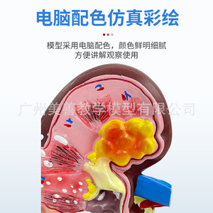 Simulation pédagogique de la structure et de l'anatomie du rein humain ; organes internes malades ; urologie ; glomerules ; néfons - Product Image 5