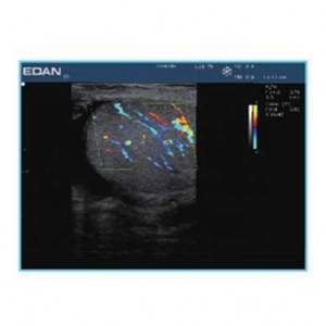 <span class=keywords><strong>Edan</strong></span> U50 Portable Color Doppler <span class=keywords><strong>Ultrasound</strong></span> Pemindai Ultrasonografi Superior - Product Image 4