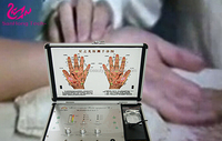 Analyseur de méridiens électrostatiques corporels multifréquence, mise à niveau 2026, instrument d'acupuncture pour la santé secondaire
