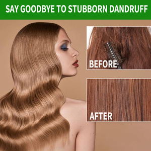 Huile de Batana du Mexique, best-seller en Asie du Sud-Est, huile essentielle pour les soins capillaires, nourrit, lisse, renforce, anti-frisottis, pour tous les types de cheveux - Product Image 2