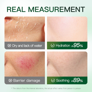 SADOER Hoja Mascarilla facial Pepino Aloe Fórmula hidratante para reparar la piel agrietada áspera y control efectivo del aceite - Product Image 5