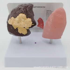Modèle de comparaison des poumons sains et des poumons pathologiques ; Comparaison des poumons normaux et des poumons pathologiques ; Section anatomique de - Product Image 3