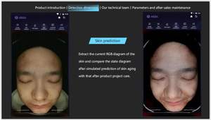 Analizador de Piel 3D con 3 Cámaras y Tecnología de IA, Escáner Facial 3D con 48 Millones de Píxeles, Precio de Fábrica 2025 - Product Image 5