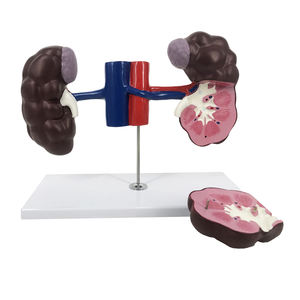 Gelsonlab HSBM-523 MODEL ginjal kanan dan kiri - Product Image 1