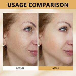 رقع الكولاجين |   غني بفيتامين سي والأحماض الأمينية وحمض الهيالورونيك |   يشد البشرة |   يرطب ويغذي |   30 لصقة - Product Image 5