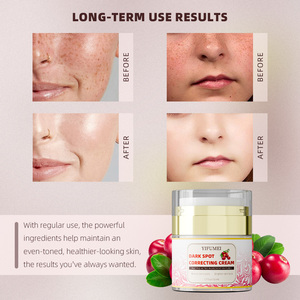 Productos para el Cuidado de la Piel al por Mayor, los Mejores del Mundo, <span class=keywords><strong>Crema</strong></span> Facial <span class=keywords><strong>con</strong></span> Alfa Arbutina, <span class=keywords><strong>Hidratante</strong></span>, Blanqueadora, Correctora de Manchas Oscuras, para una Piel Radiante - Product Image 3