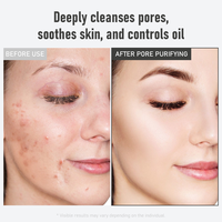Vente en gros de masque de boue de la mer Morte avec extrait de calendula, huile d'amande, nettoyage en profondeur, traitement des pores pour le visage