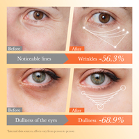OEM ODM Produit de beauté BIOAQUA Vitamine E + B5 Crème raffermissante et réparatrice pour les yeux Sérum hydratant pour le contour des yeux atténuant les ridules sèches