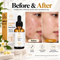 Sérum Visage Anti-Imperfections et Anti-Acné au Soufre Colloïdal Fermenté, Niacinamide et Acide Salicylique pour le Contrôle des Pores et du Sébum