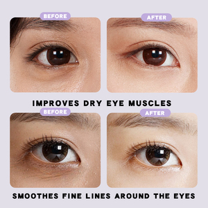 Etiqueta privada Elimina las ojeras, borra las arrugas alrededor de los ojos, ralentiza el envejecimiento, elimina las bolsas de los ojos, conjunto para el cuidado de la piel de los ojos - Product Image 5