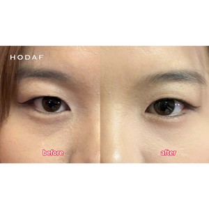 Patchs Oculaires Dissolvants à Micro-aiguilles à l'Acide Hyaluronique <span class=keywords><strong>Anti</strong></span>-rides, Atténuent les <span class=keywords><strong>Cernes</strong></span> et Réduisent les Poches sous les Yeux, Soin de la Peau - Product Image 3
