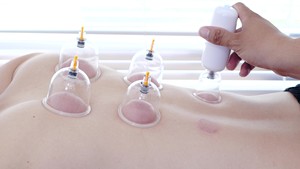 Professional Traditional <strong>Medical</strong> <strong>Cupping</strong> and Guasha Massager Set Electric Vaccum <strong>Cupping</strong> Therapy Machine - Product Image 5