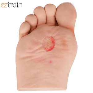 Modello Anatomico <span class=keywords><strong>di</strong></span> Piede Diabetico per l'<span class=keywords><strong>Educazione</strong></span> <span class=keywords><strong>e</strong></span> la <span class=keywords><strong>Formazione</strong></span> in <span class=keywords><strong>Scienze</strong></span> Mediche - Product Image 5