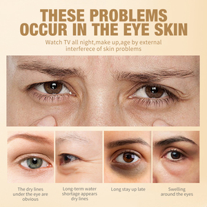 11 phong cách khác nhau mắt Kem Bộ sưu tập mắt tối loại bỏ vòng tròn Kem làm sáng chống lão hóa làm săn chắc chăm sóc mắt thắt chặt Kem - Product Image 4