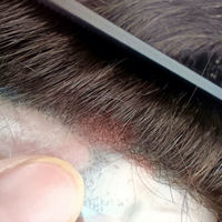 Prothèse capillaire ultra-fine de 0,03 mm pour hommes, système de remplacement capillaire Remy à boucles en V, ligne de cheveux indétectable, postiche naturel pour hommes