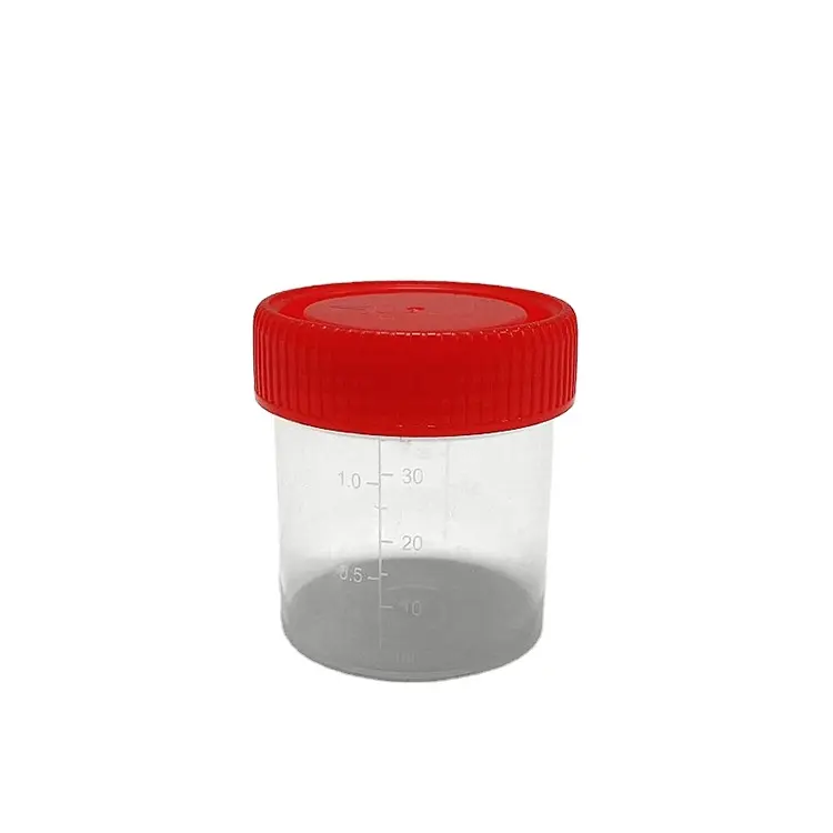Contenedor de orina de material plástico femenino de laboratorio de 60ml, 100ml, 120ml, contenedor de orina de laboratorio estéril con tapa roja