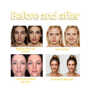 Sabun Pembersih kunyit pencerah, sabun pembersih kunyit pengurang Noda, pencerah dan pelembut - Product Image 3