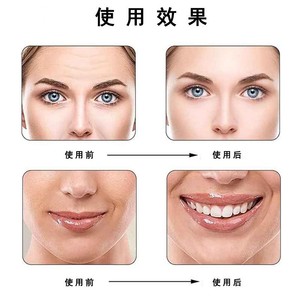 แผ่นมาส์กหน้าซิลิโคน OEMODM ป้องกันริ้วรอย ขนาดเดียว ใส บางเฉียบ สำหรับบริเวณคอ ตา หน้าอก หน้าผาก ช่วยยกกระชับ - Product Image 4