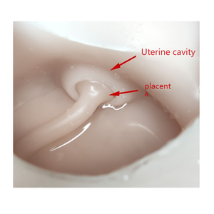 의료 교육 모델 초음파 유도 양수 및 제대혈 천자 훈련 모델 - Product Image 5
