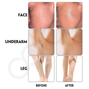 Luxfume Spray démaquillant indolore non sensible Public et zone de bikini Crème épilatoire - Product Image 6