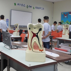 Modelo <span class=keywords><strong>de</strong></span> Patología Dental para Educación Dental y Laboratorio Dental, Modelo <span class=keywords><strong>de</strong></span> Estudio Dental - Product Image 6