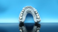 Impresora 3D Dental SLM de Alta Velocidad, Máquina de Fabricación Aditiva Industrial por Fusión Selectiva Láser de Metal