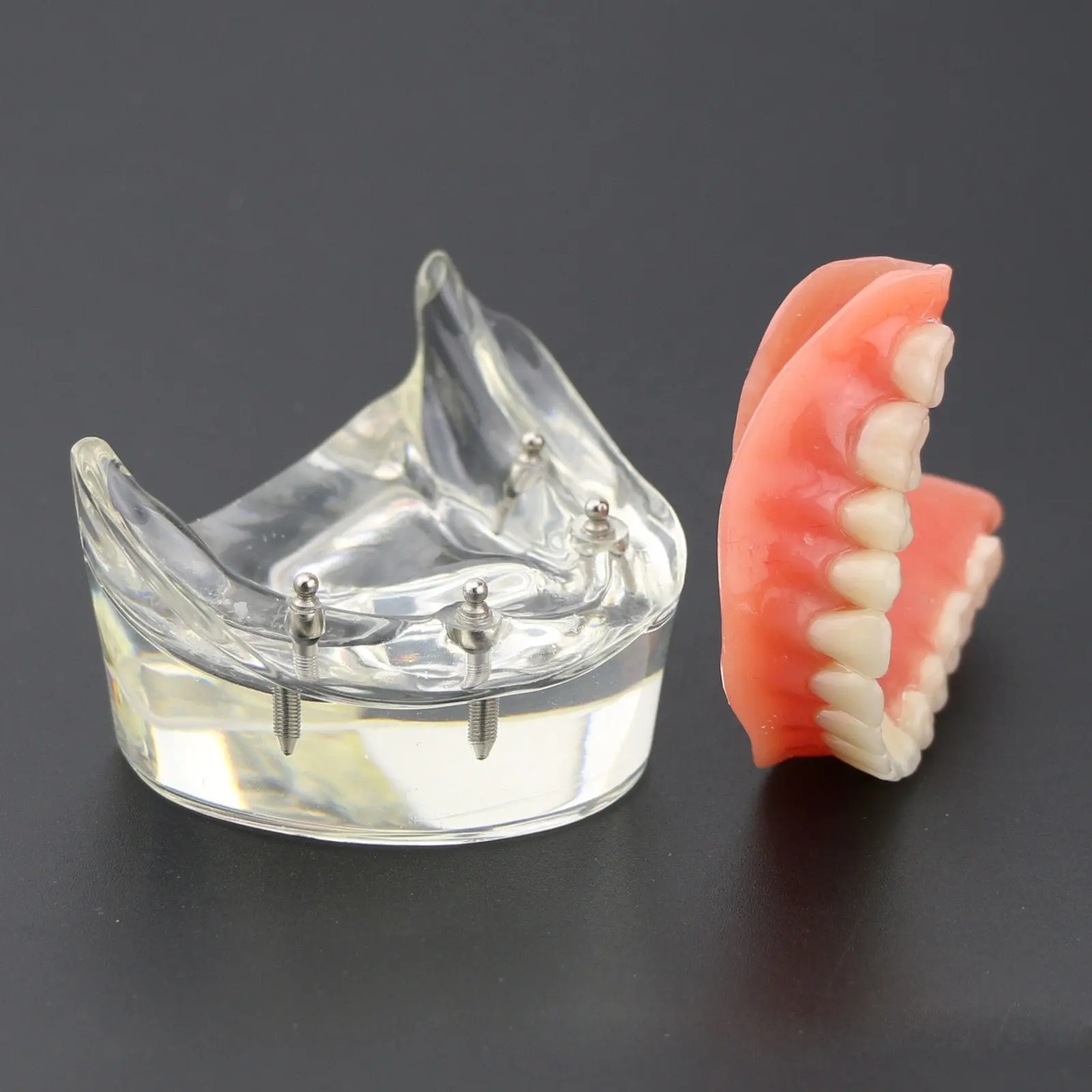 Modelo de restauración de dentaduras Dental, modelo de estudio Dental, gran oferta