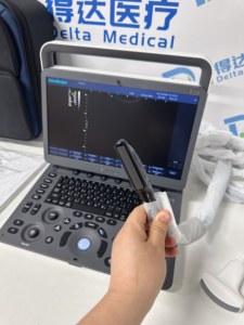 Sonoscape E1V - Escáner de Ultrasonido Veterinario Portátil de Excelente Calidad para Diagnóstico de Embarazo en Caninos/Felines - Product Image 5