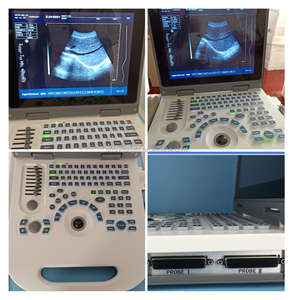 Penjualan terlaris SUN-806G <span class=keywords><strong>ultrasound</strong></span> medis BW <span class=keywords><strong>Ultrasound</strong></span> 2D ginekologi notebook kehamilan mesin <span class=keywords><strong>ultrasound</strong></span> USG - Product Image 2