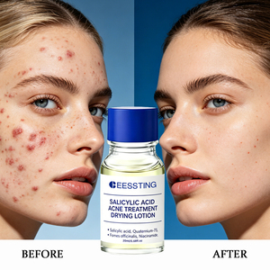 Sérum Visage Anti-âge et Anti-acné en Gros : Éclat, Réduction des Rides, Blanchissant, Apaisant et Nourrissant en Profondeur - Product Image 2