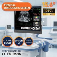 Écran portable SIBOLAN 15,6 pouces tactile FHD OLED IPS pour diagnostic échographique, affichage des signes vitaux du patient sur chariot, type C