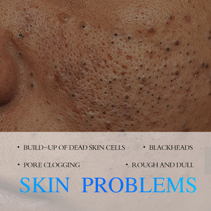 KORMESIC Certifié Bpom Vente en gros 200g Gel exfoliant pour le visage et le corps aux fruits Nettoyant visage lissant et éclaircissant - Product Image 5