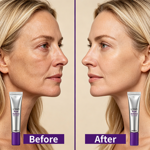 Etiqueta Personalizable, Crema Contorno de Ojos con Retinol y Pro-Xylane de 15 ml, Reduce Arrugas, Hinchazón y Ojeras, para Mujeres - Product Image 4