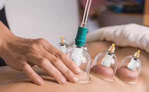 Taşınabilir profesyonel çin 22-Cup akupunktur çukurluğu terapi seti Hijama masaj kiti vücut uygulama için vakum manyetik pompa - Product Image 5